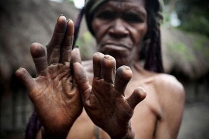 Horrific customs of the Papuans can shock