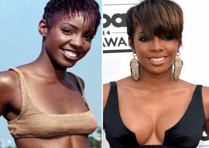 10 stars, who are not shy, that their breasts are not real