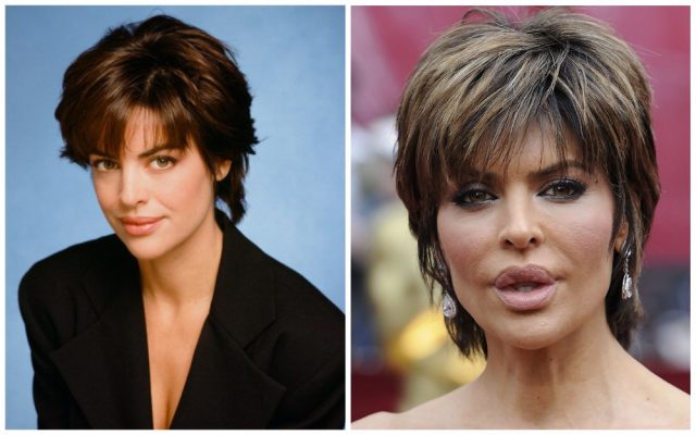 Attractive Celebs Who Lost Their Beauty - Inpic.net