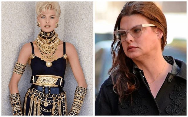 Attractive Celebs Who Lost Their Beauty Page 4 Of 30 Inpic