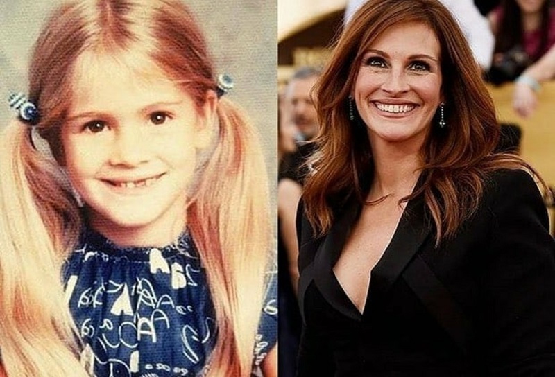 From School Kids to Superstars: 25 Celebs Before and After